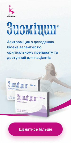 Боковий банер